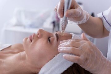 Microneedling Behandlung mit einem Dermapen auf der Stirn einer Frau